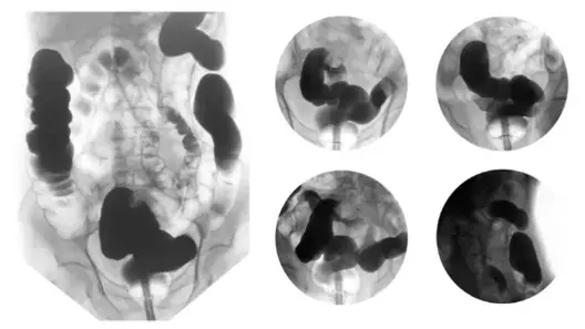 Medical Graphic
