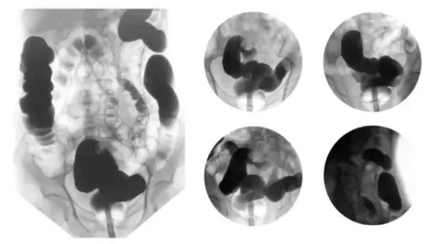 Medical Graphic