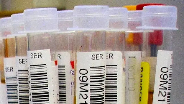 blood samples